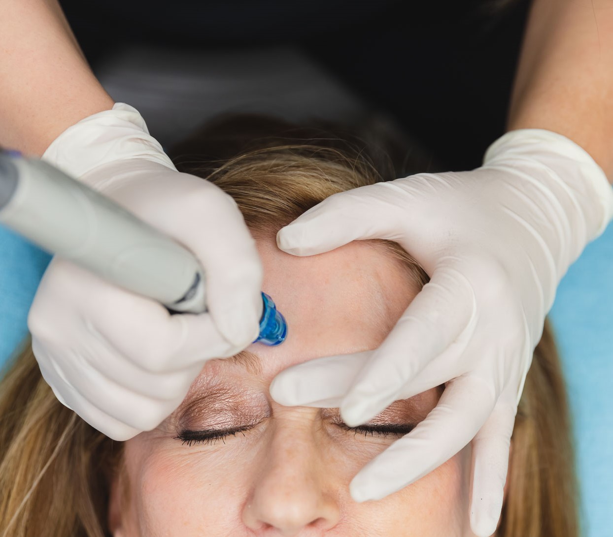 Photo of woman as she receives an exfoliating facial in Oxford with Hydrafacial