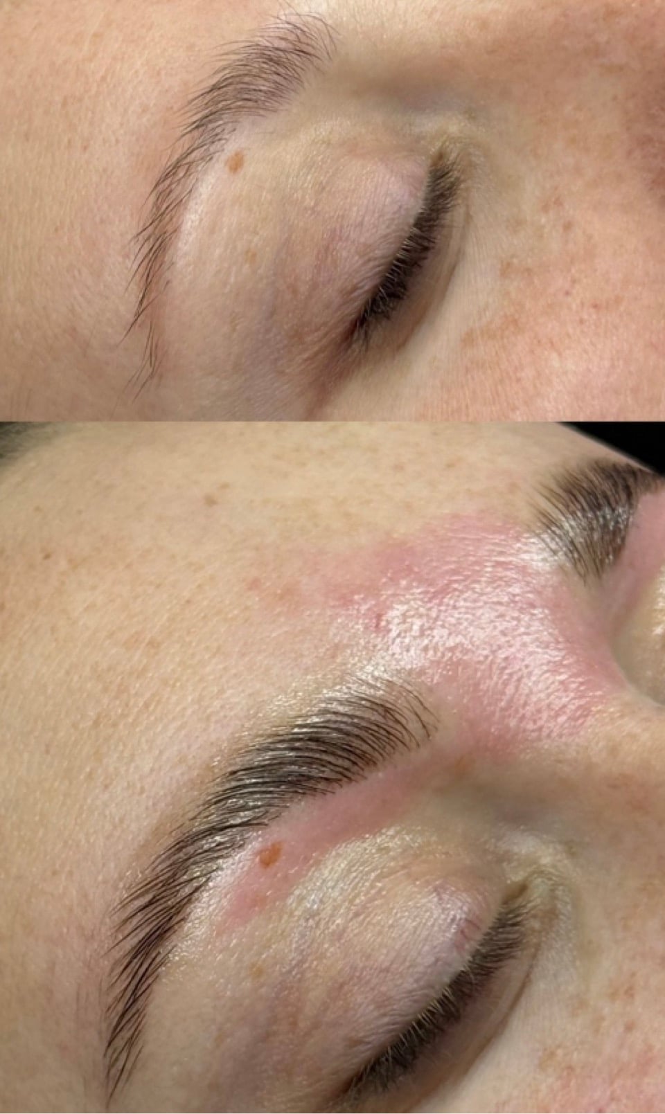 Brow bundle service at Revive Wellness Clinic